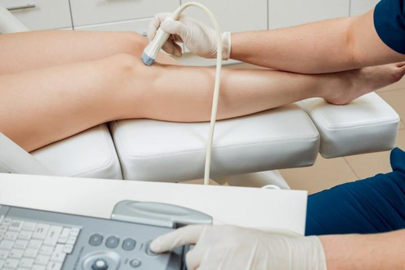 УЗИ сосудов верхних и нижних конечностей 